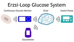 Focusing-on-life-with-an-opensource-artificial-pancreas.jpg